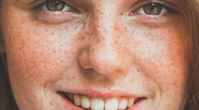 smiling, ginger haired lady with freckled skin