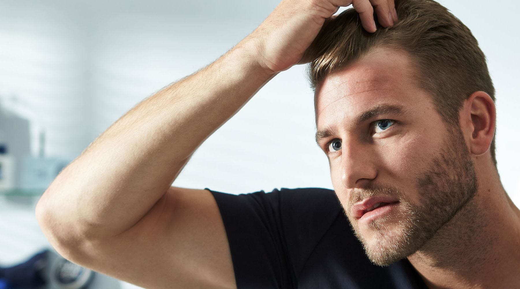Izpadanje las pri moških: kaj pomaga?